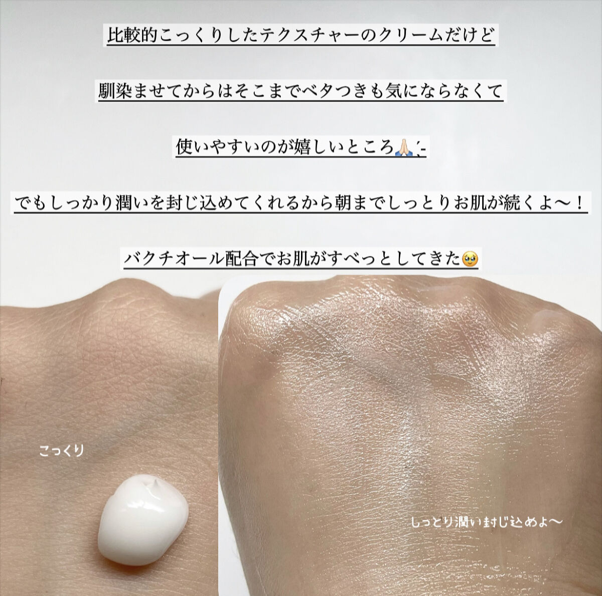 バクチオールA コアクリーム/23years old/フェイスクリームを使ったクチコミ（3枚目）