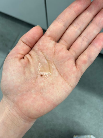 RXザ・アルファアルブチン2 ニキビ跡ケアセラム/COSRX/美容液を使ったクチコミ(3枚目)