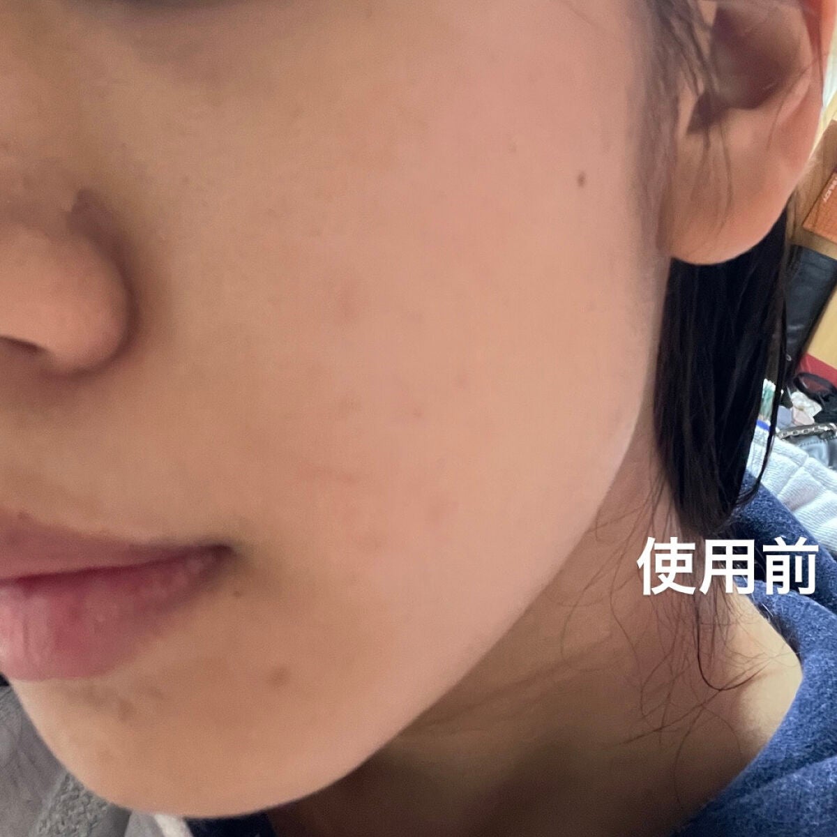 バイオ コンディショニング エッセンス/IOPE/ブースター・導入液を使ったクチコミ(2枚目)