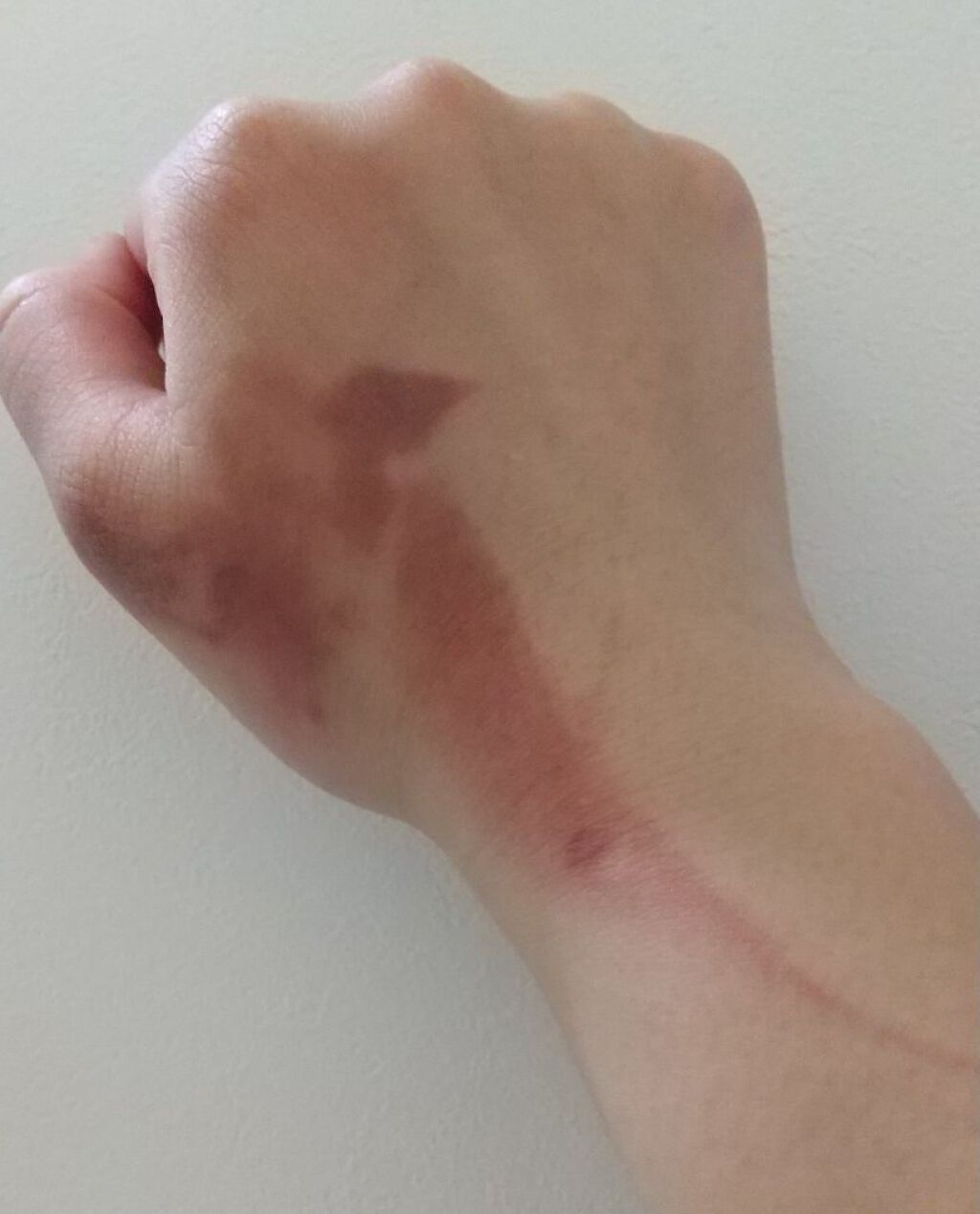 yumetamago on LIPS 「こんにちは!写真が少しグロくて申し訳ないですm(*__)m今回..」(2枚目)