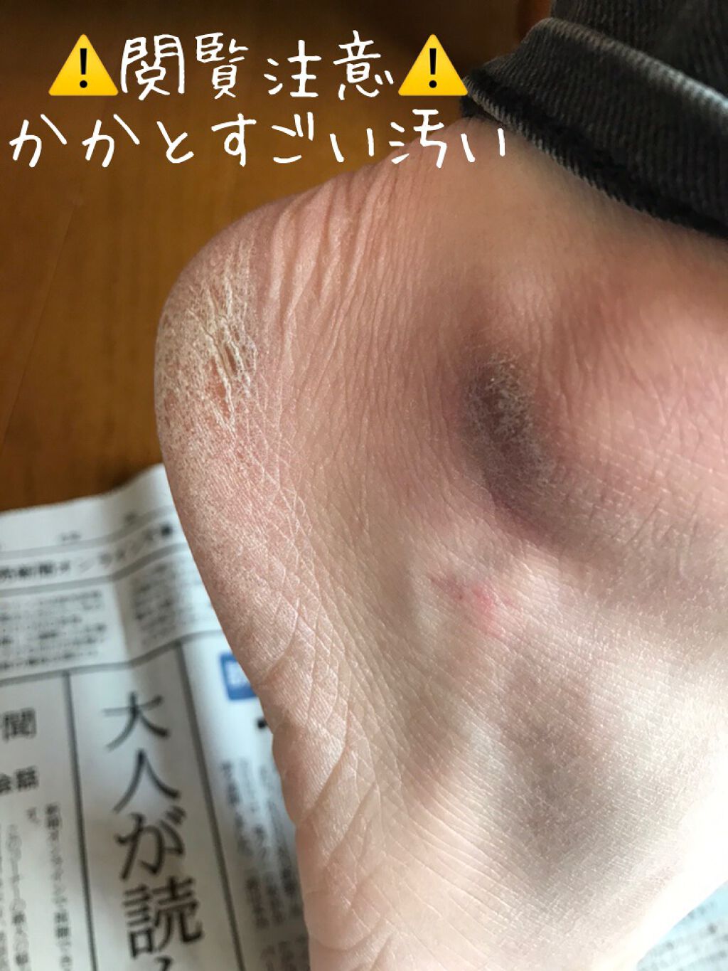 試してみた】5セカンズシャインかかと角質削り/5セカンズシャイン | LIPS 試してみた】5セカンズシャインかかと角質削り/5セカンズシャイン | LIPS