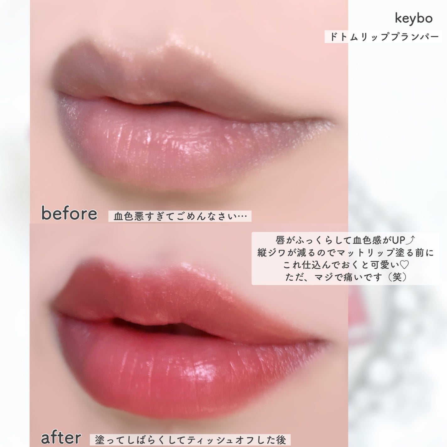 ドトムリッププラスプランパー/keybo/リッププランパーを使ったクチコミ(3枚目)