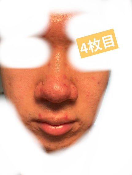 デイリーケアマスク ヒアルロン酸&グレープフルーツ/RISM/シートマスク・パックを使ったクチコミ(4枚目)