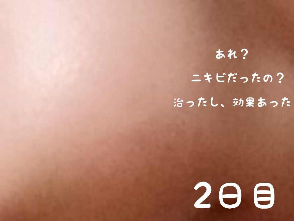 バイオイル/バイオイル/フェイスオイルを使ったクチコミ(2枚目)