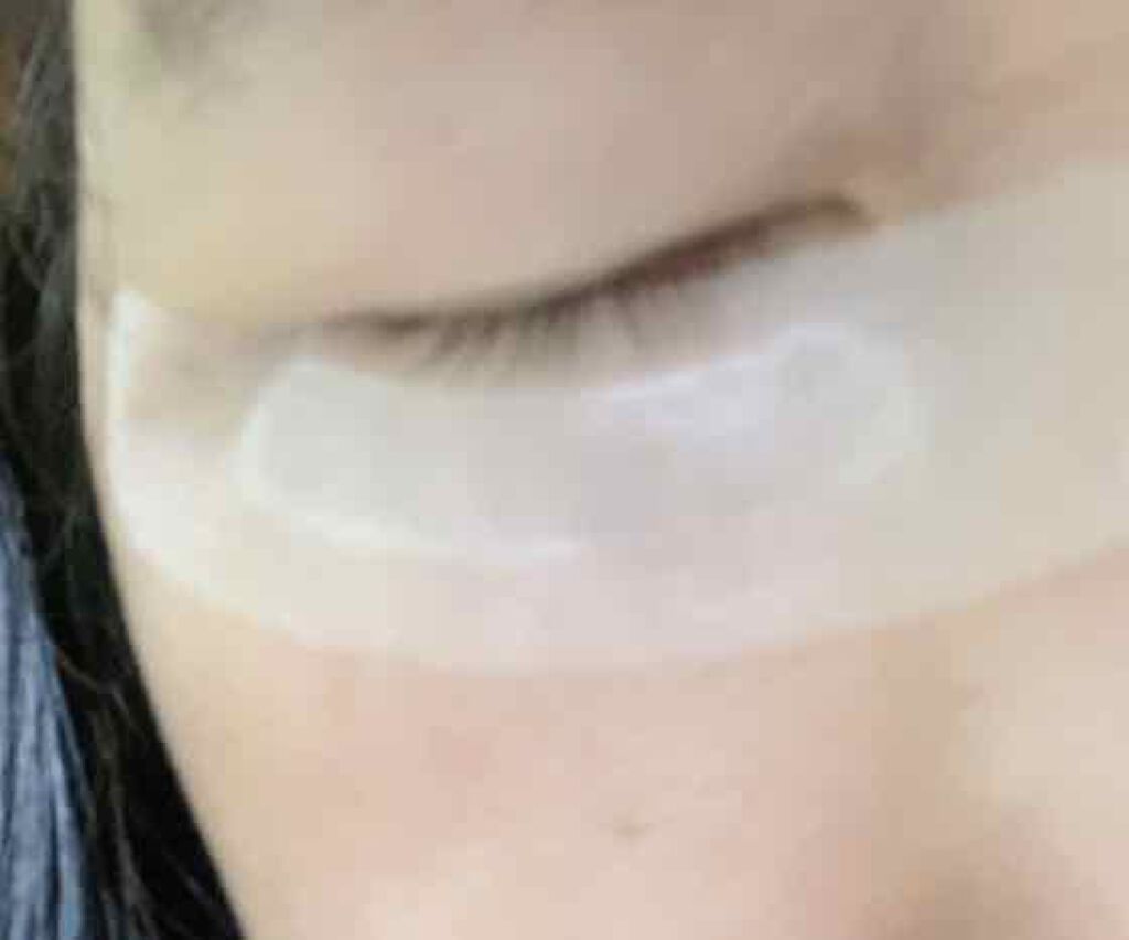 ナチュラベーレ THEマイクロニードル/ナチュラベーレ/シートマスク・パックを使ったクチコミ（3枚目）