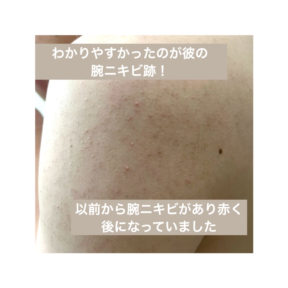 ターンオーバークリーム/REJURAN COSMETICS/フェイスクリームを使ったクチコミ（2枚目）