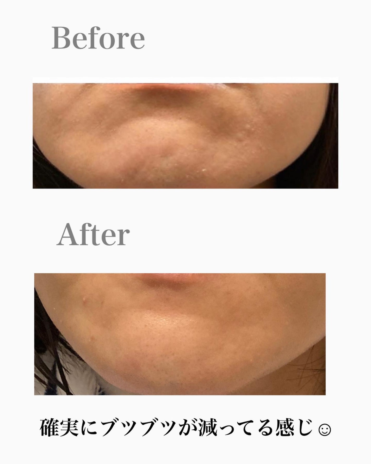 Kooスキンローション/Koo/化粧水を使ったクチコミ(7枚目)