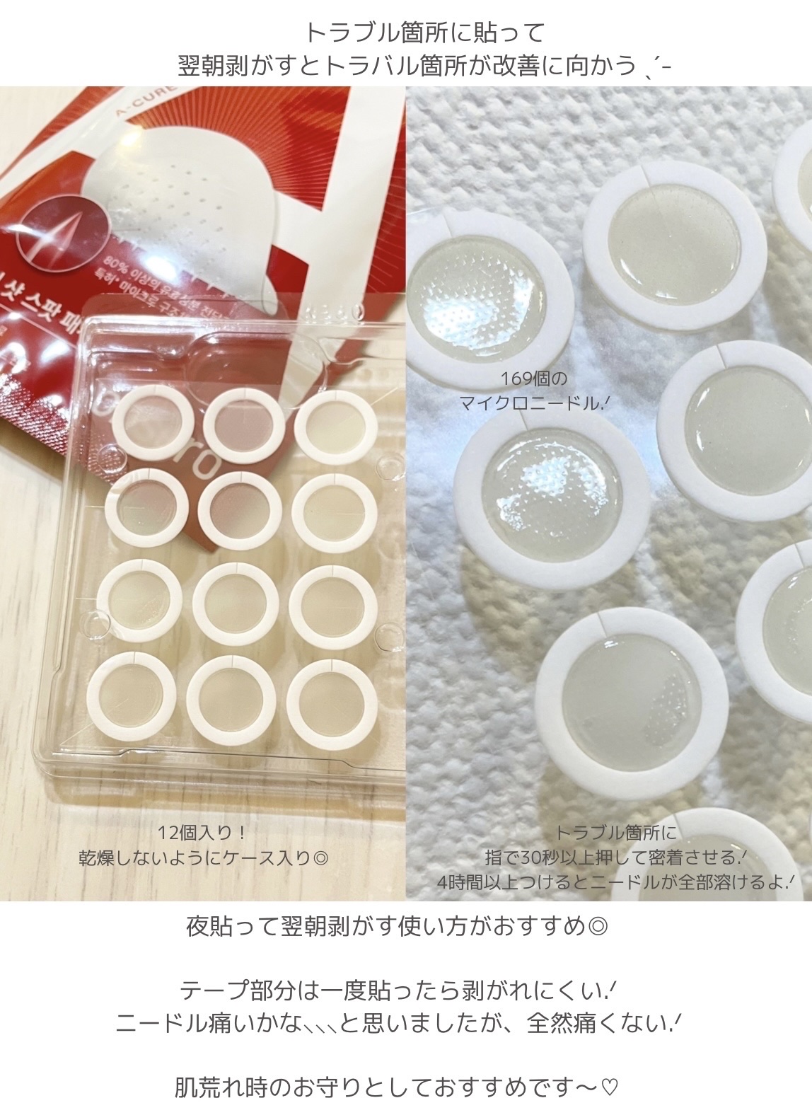 エーキュアショットスポットパッチ/obsero/にきびパッチを使ったクチコミ（3枚目）