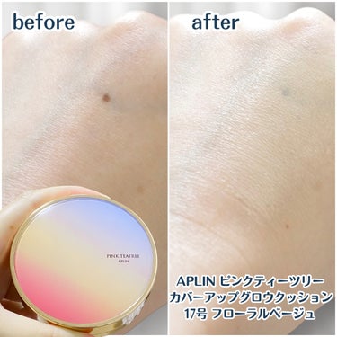 ⁡
⁡
✼••┈┈┈┈┈┈┈┈┈┈┈┈┈┈┈┈••✼
⁡
ブランド:APLIN(アプリン)
商品: ピンクティーツリーカバーアップグロウクッション
カラー: 17号フローラルベージュ
⁡
#高カバー
#