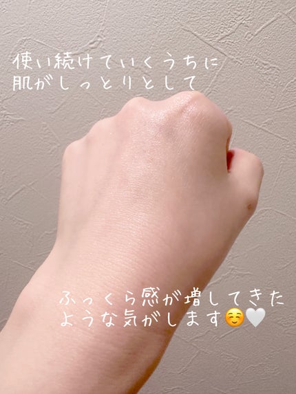 PDRNヒアルロン酸カプセル100セラム/Anua/美容液を使ったクチコミ(4枚目)