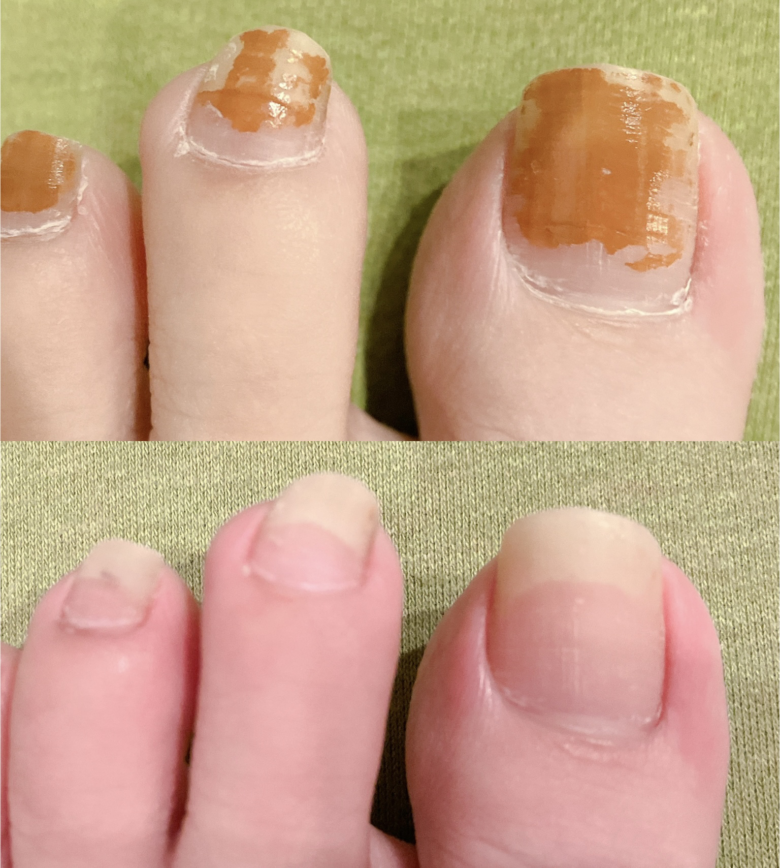 ピュア マイルド エナメルリムーバー/コーセーコスメポート/除光液を使ったクチコミ（2枚目）