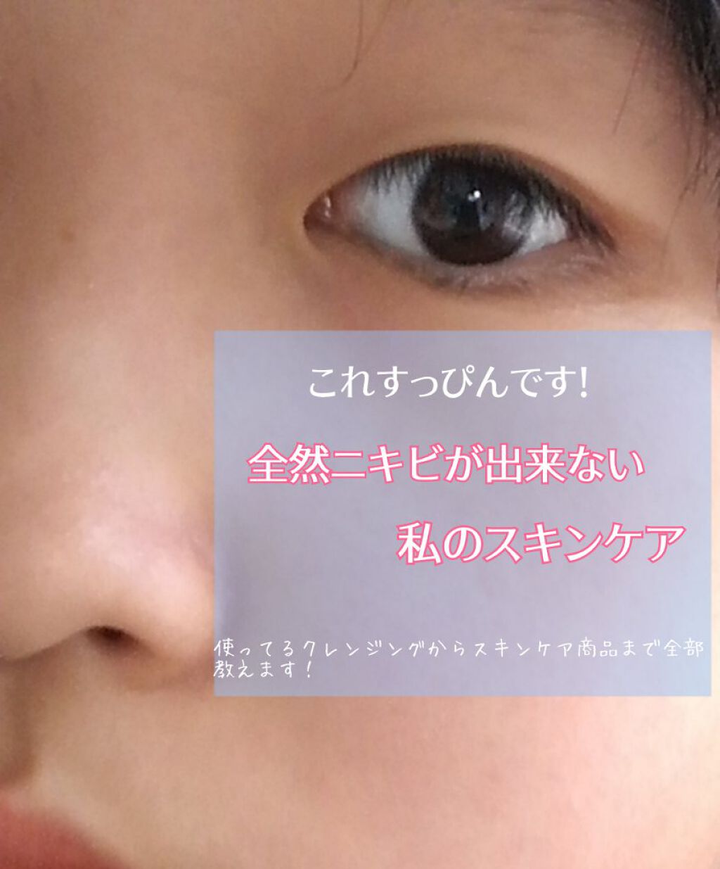 薬用洗顔フォーム/スキンライフ/洗顔フォームを使ったクチコミ(1枚目)