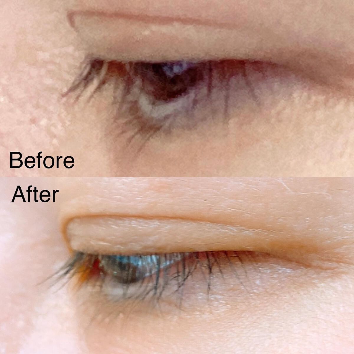 EMAKED(エマーキット)/水橋保寿堂製薬/まつげ美容液を使ったクチコミ(4枚目)