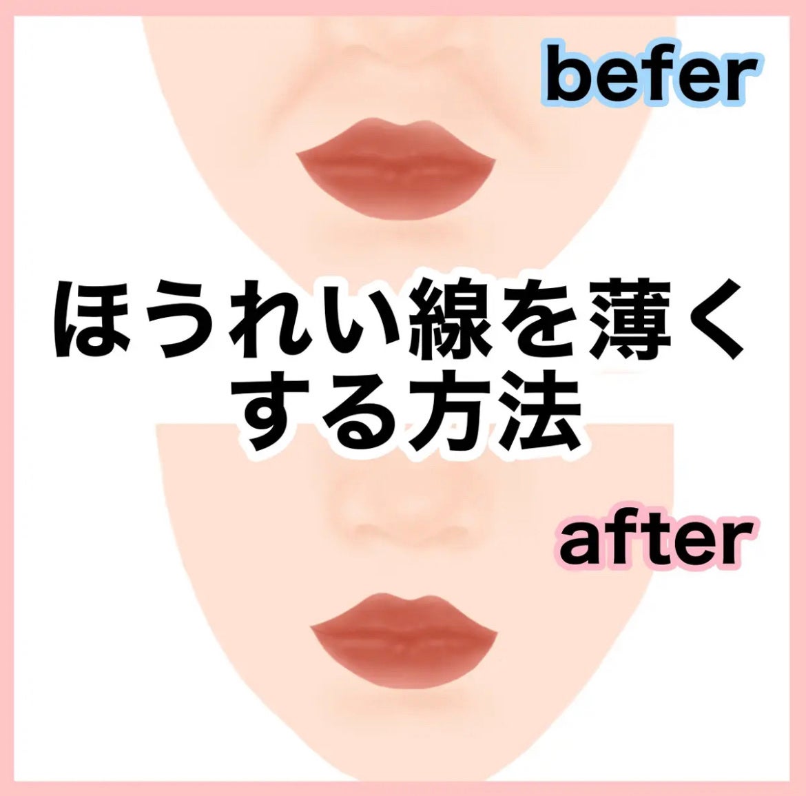 ミリミリ|美容アカウント on LIPS 「『ネットではあまり教えてくれないほうれい線を薄くする方法』たる..」(1枚目)