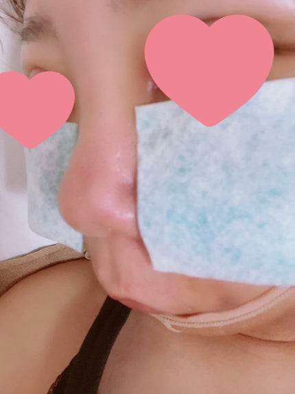 ニョッキ on LIPS 「ついに頬・顎下脂肪吸引&メーラーファット除去しました🌟1日目〜..」(6枚目)