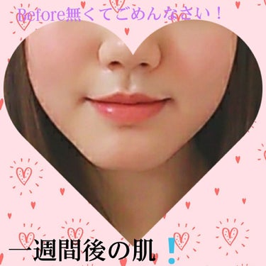 敏感肌用薬用美白美容液/無印良品/美容液を使ったクチコミ（2枚目）