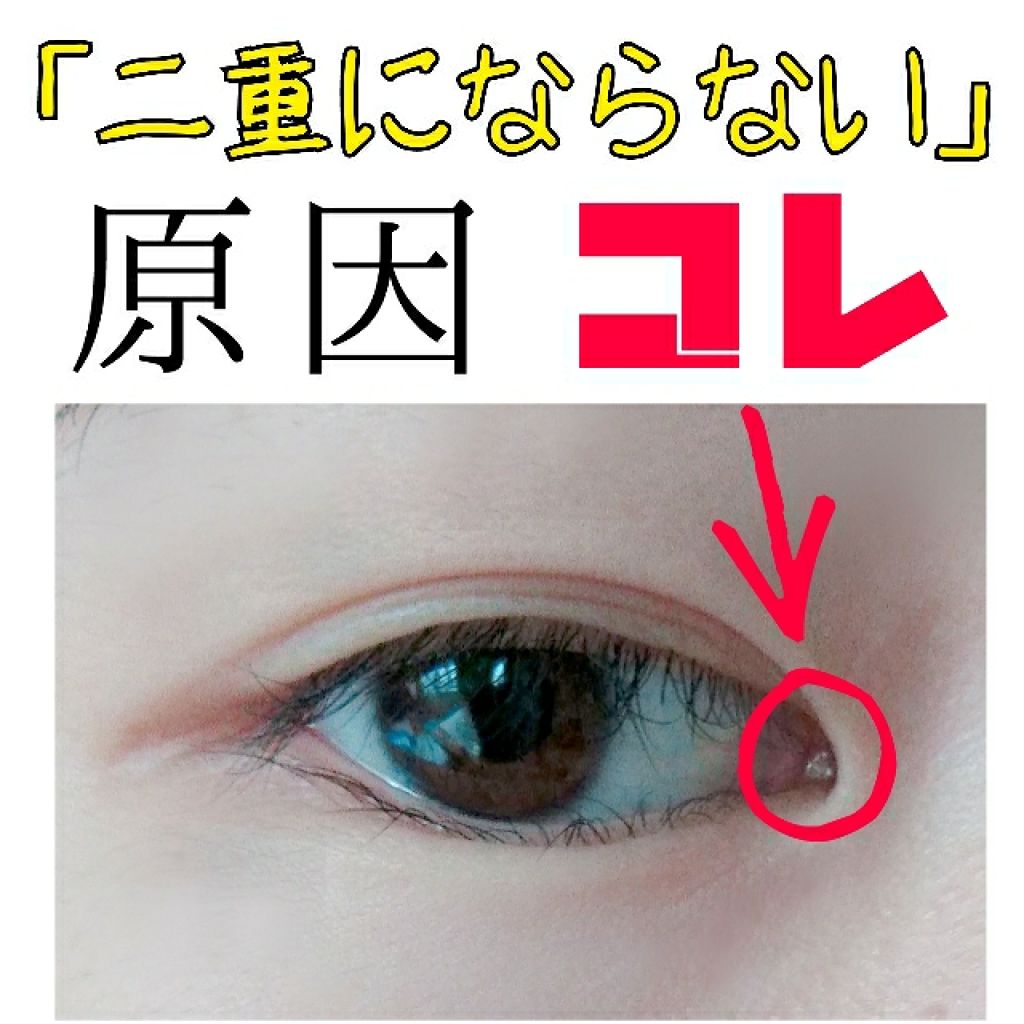 のびーるアイテープ(絆創膏タイプ、レギュラー)/DAISO/二重まぶた用アイテムを使ったクチコミ(1枚目)