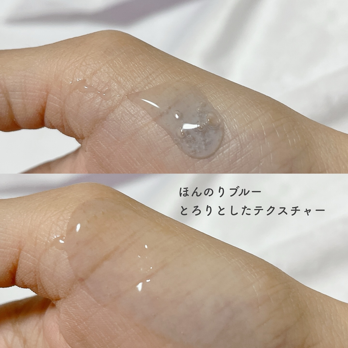 ニードルセラムAZ/fractionalCC/美容液を使ったクチコミ（3枚目）