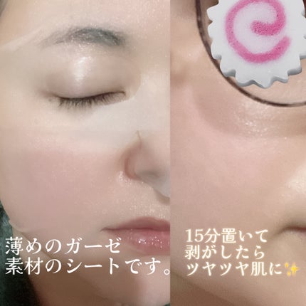 ダーマレーザー スーパー VC100 ホワイトマスク/クオリティファースト/シートマスク・パックを使ったクチコミ(4枚目)