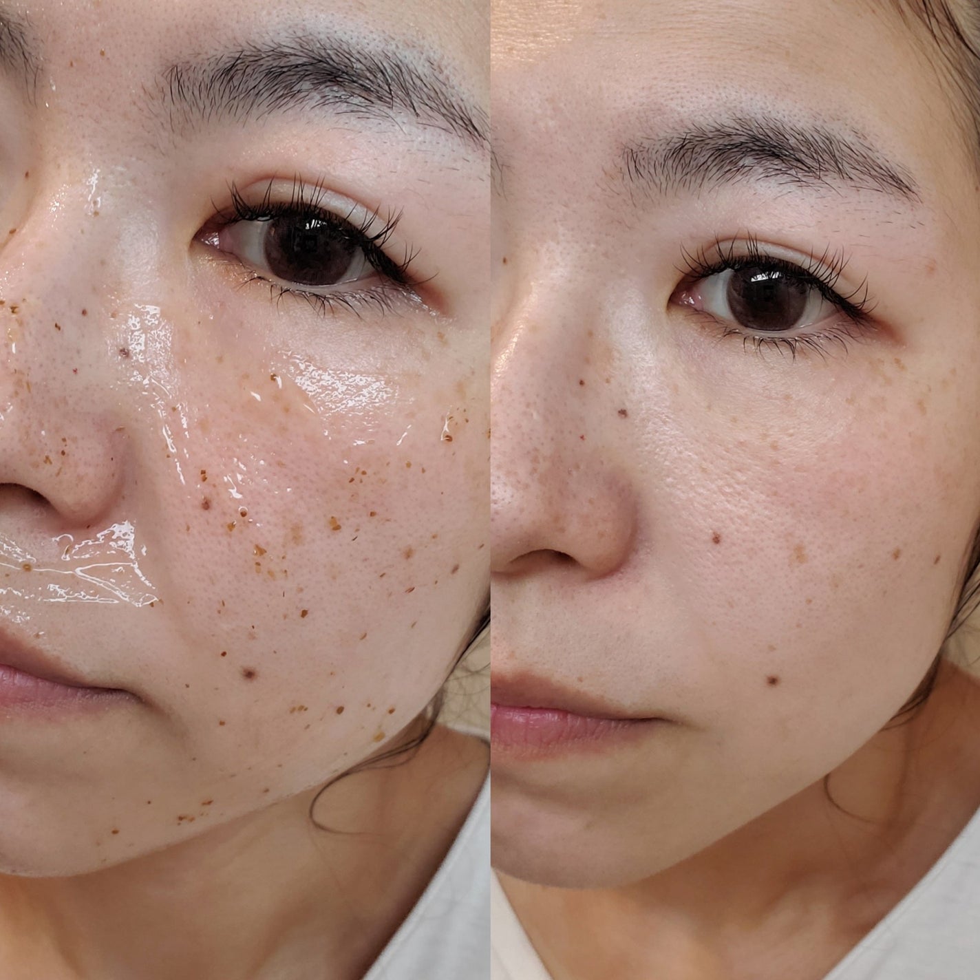 リアルシカペストパック/ビューランチ/洗い流すパック・マスクを使ったクチコミ(6枚目)