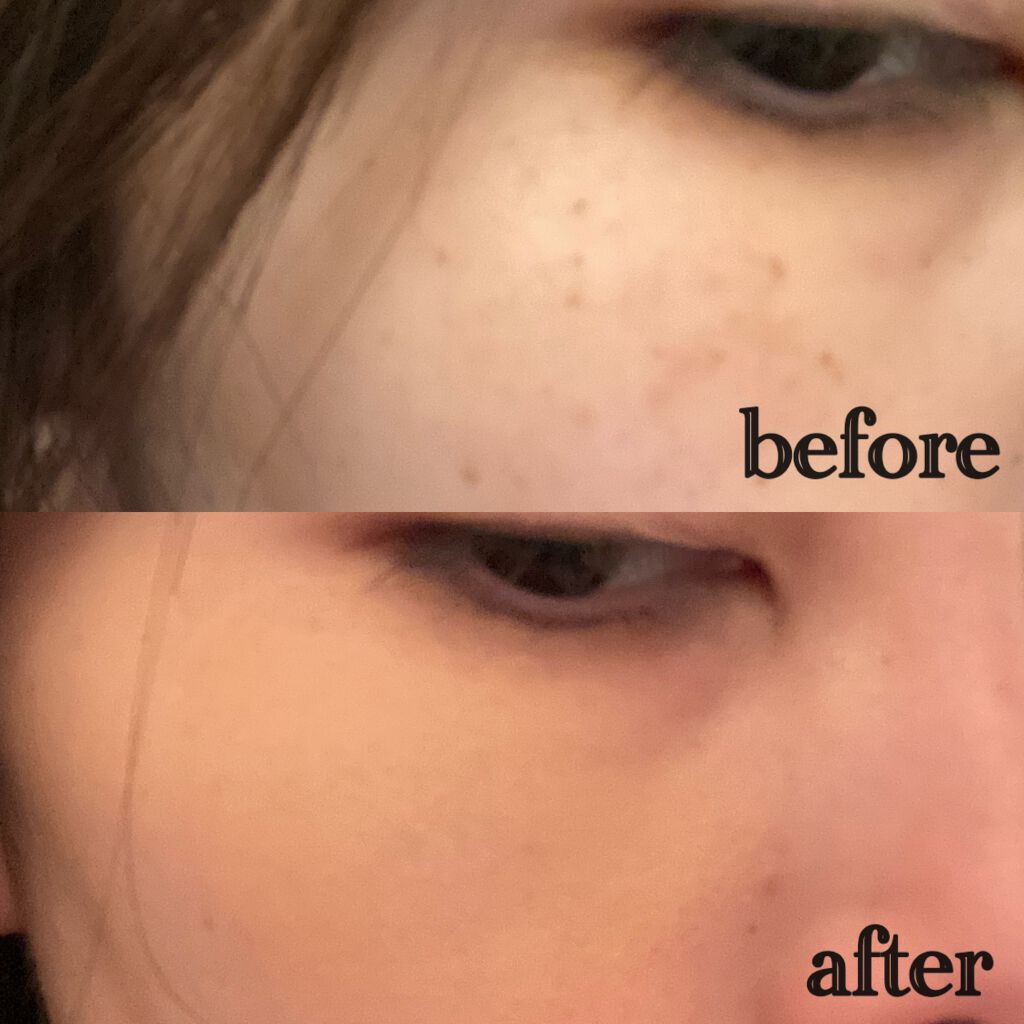 スポッツカバー ファウンデイション/SHISEIDO/クリームコンシーラーを使ったクチコミ(2枚目)