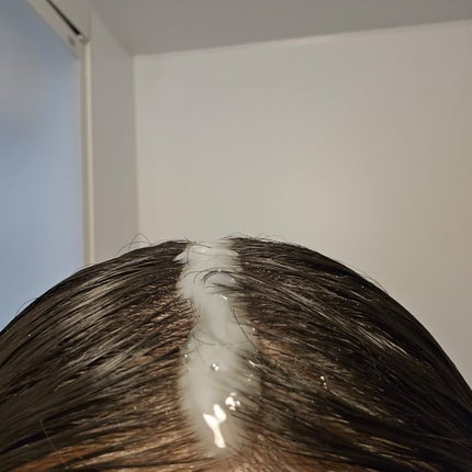 スパークリングスカルプスケーラー/ミンツリー/頭皮ケアを使ったクチコミ(3枚目)