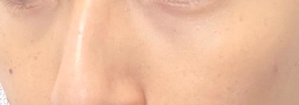 【旧】ディオールスキン フォーエヴァー スキン コレクト コンシーラー/Dior/リキッドコンシーラーを使ったクチコミ(6枚目)