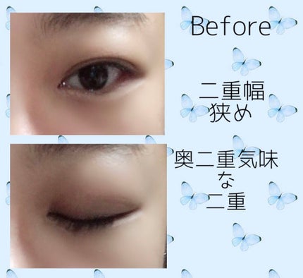 フリーファイバー120 スタンダードタイプ /メザイク/二重まぶた用アイテムを使ったクチコミ(3枚目)