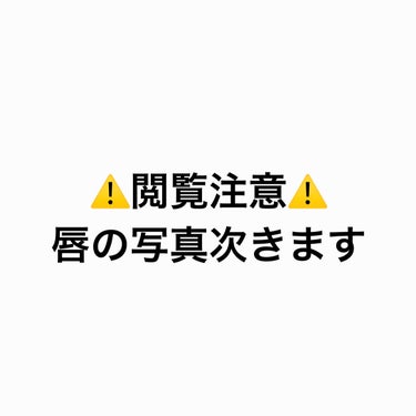 ルージュ リップブロッサム ペタルグロウ/JILL STUART/口紅を使ったクチコミ（2枚目）