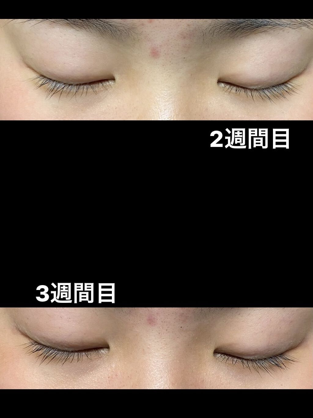 ラッシュケアエッセンス/キャンメイク/まつげ美容液を使ったクチコミ（3枚目）