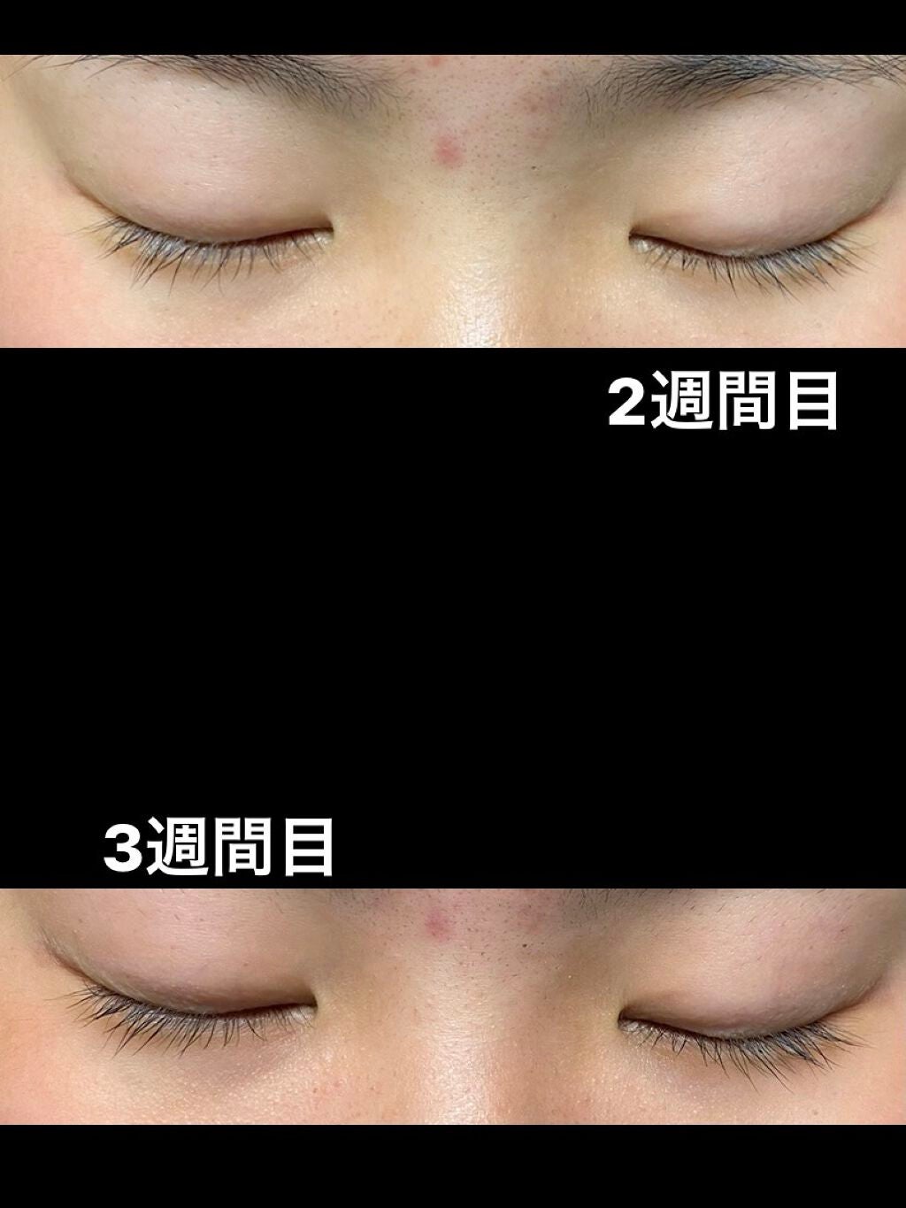 ラッシュケアエッセンス/キャンメイク/まつげ美容液を使ったクチコミ(3枚目)