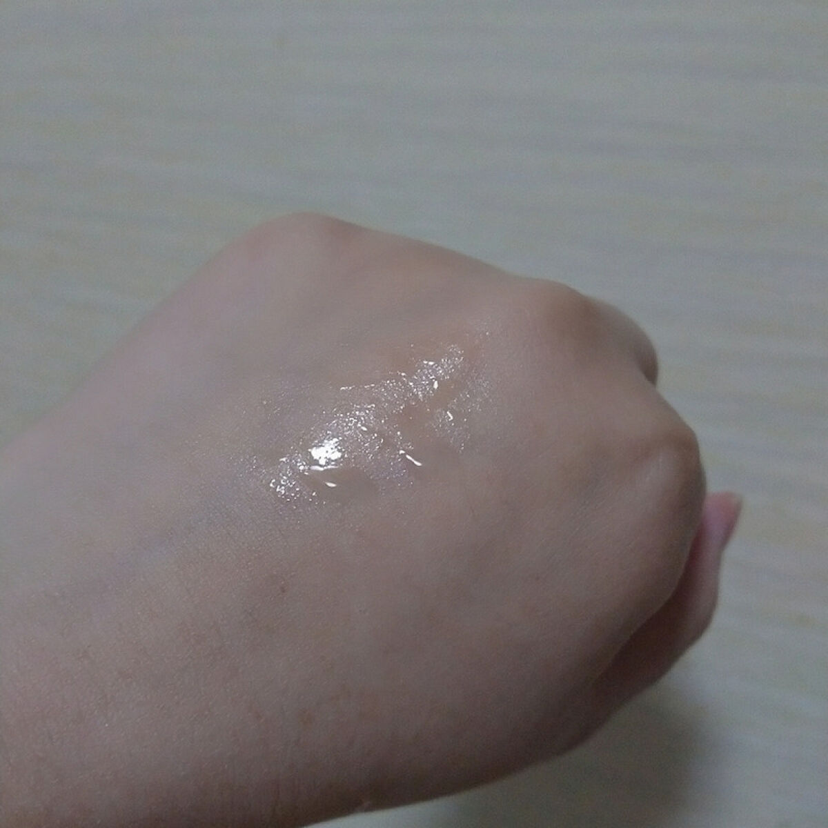 アクネケア 化粧液　＜医薬部外品＞/ファンケル/化粧水を使ったクチコミ（1枚目）