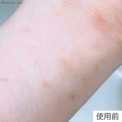 マーシュフィールド SC ボディカバーファンデN/マーシュ・フィールド/クリーム・エマルジョンファンデーションを使ったクチコミ(2枚目)