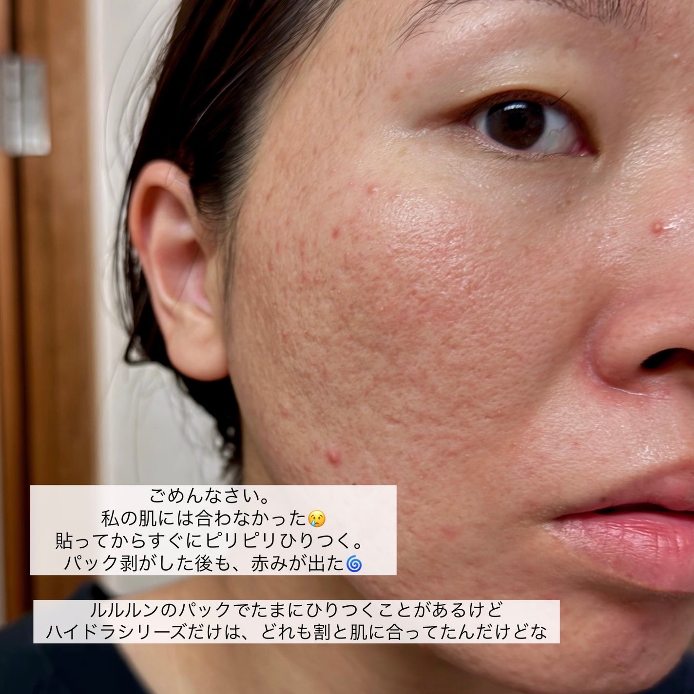 ルルルン ハイドラ AZ マスク/ルルルン/シートマスク・パックを使ったクチコミ(8枚目)