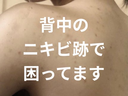 ハトムギ化粧水(ナチュリエ スキンコンディショナー R )/ナチュリエ/化粧水を使ったクチコミ(1枚目)