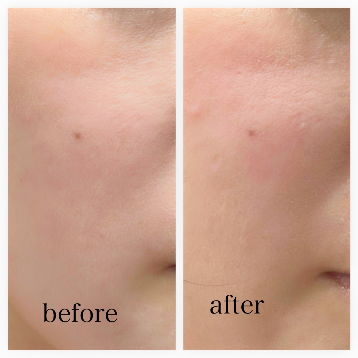 限定パウダーチーク】ディオールスキン ルージュ ブラッシュ｜Diorの