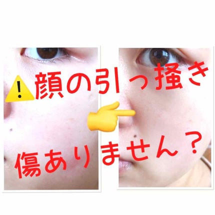 ワセリン/大洋製薬/ボディクリームを使ったクチコミ(1枚目)