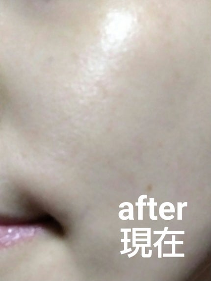 ホワイトニングエッセンス ボトル入り(28ml)/オルビス/美容液の画像