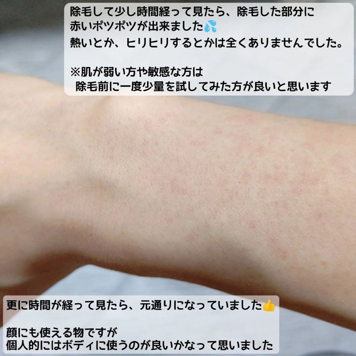 NONON/NONON(ノンノン)/除毛クリームを使ったクチコミ（3枚目）