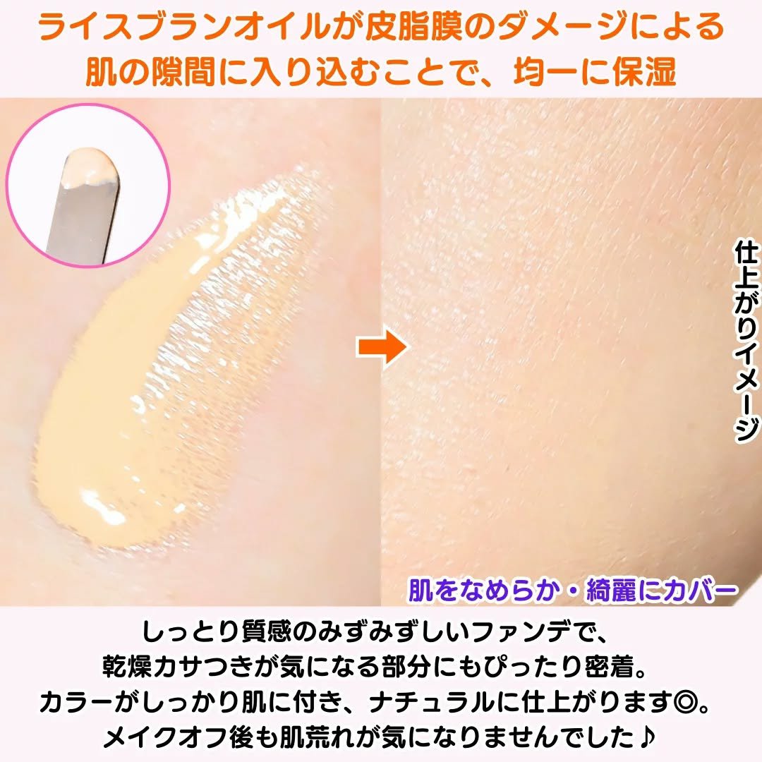 アトピロン スキンカバー ファンデーション/ATPLON/リキッドファンデーションを使ったクチコミ（3枚目）