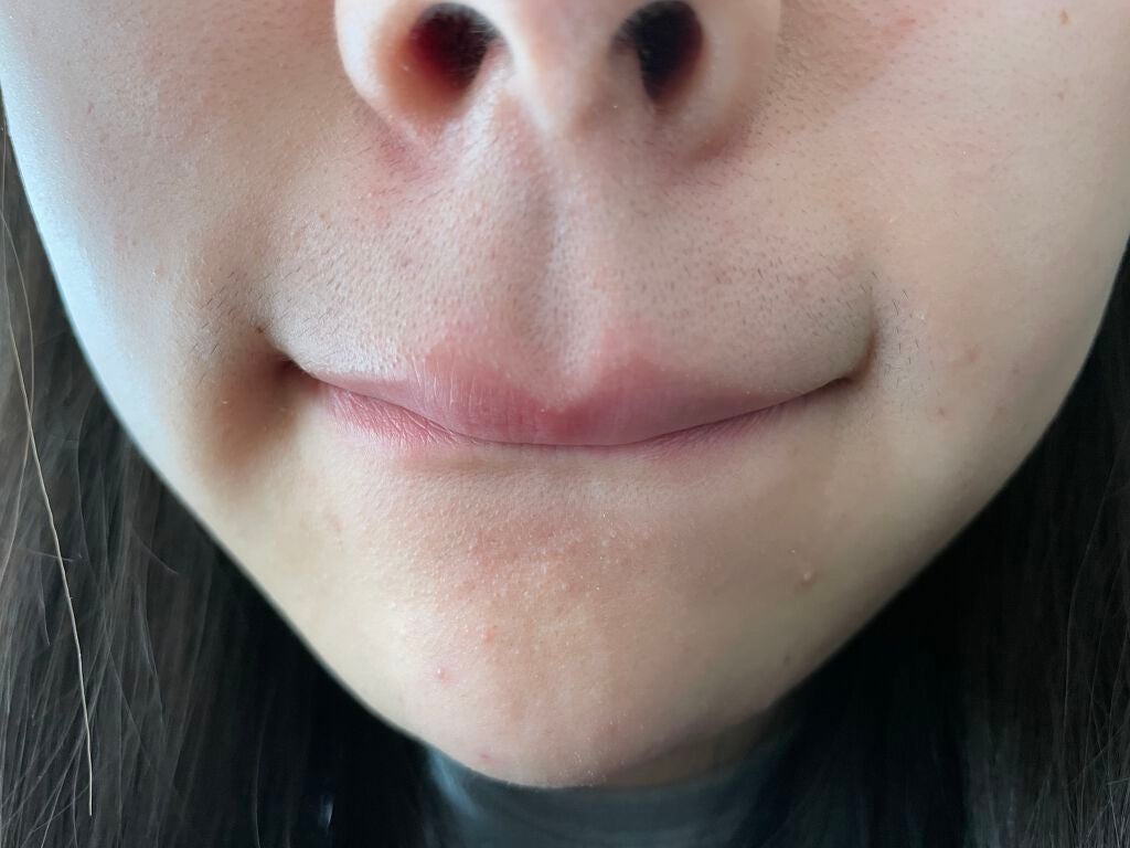 pii on LIPS 「見苦しいくてすみません😭肌の悩みを相談したくて投稿しました!さ..」(3枚目)