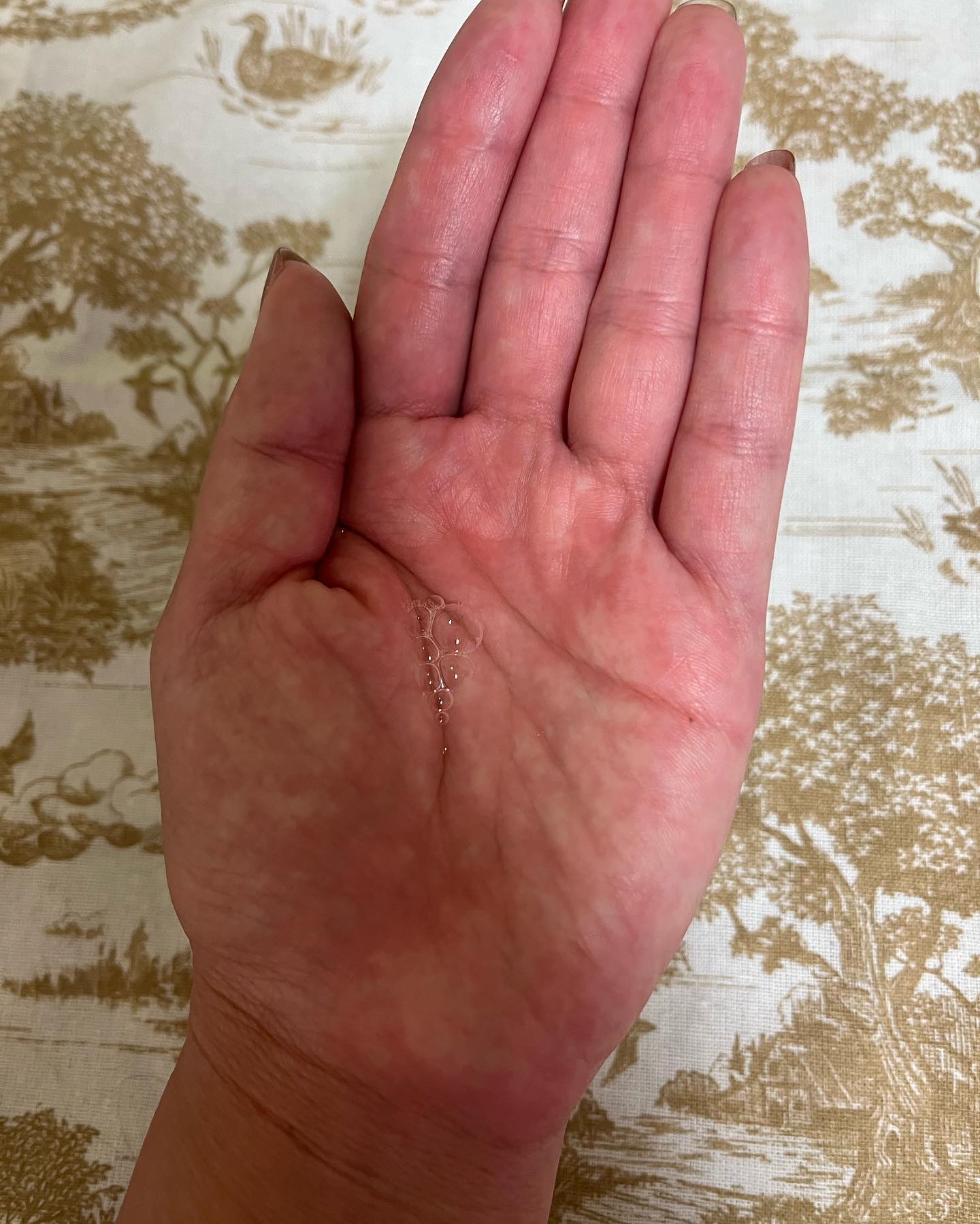 薬用 RJ地肌ケア エッセンス /アピセラピーコスメティクス/頭皮ローションを使ったクチコミ（2枚目）