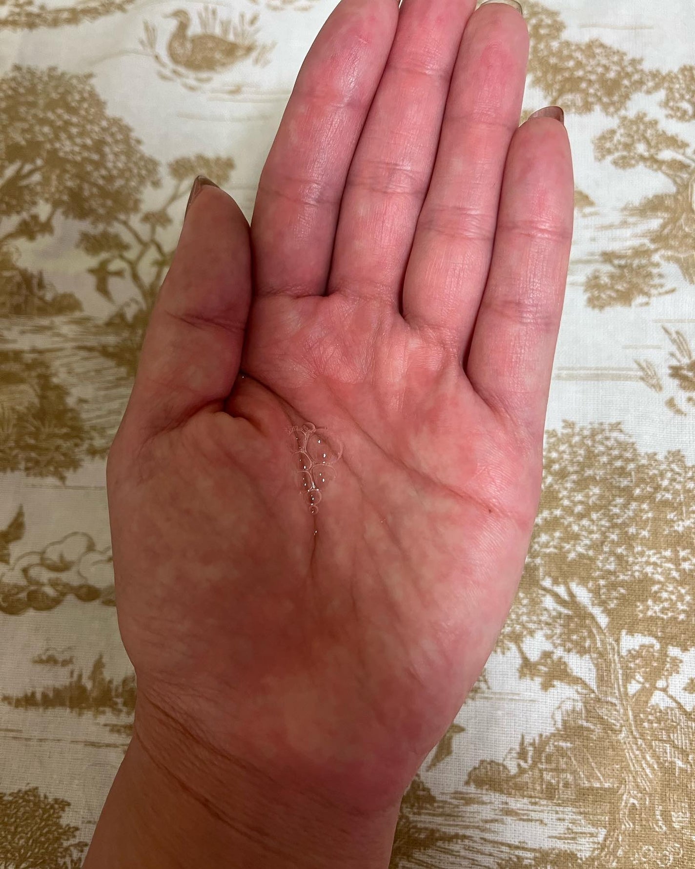 薬用 RJ地肌ケア エッセンス /アピセラピーコスメティクス/頭皮ローションを使ったクチコミ(2枚目)