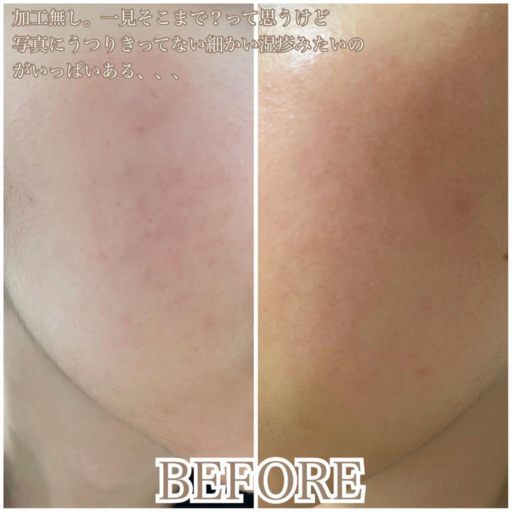 バランスケア セット W/d プログラム/スキンケアキットを使ったクチコミ（2枚目）