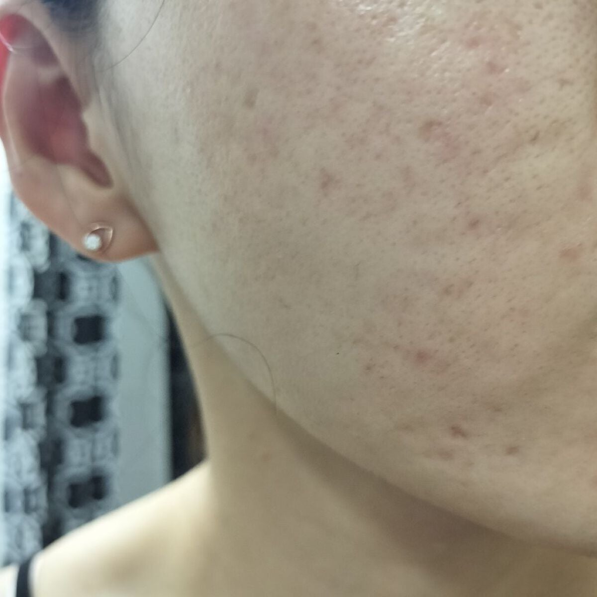 miina@汚肌工事録⚠️ on LIPS 「10/15の#汚肌工事録きょうもおつかれさまです。☕/フライト..」(1枚目)