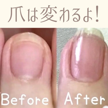 キューティクルネイルオイル ペンタイプ/No nail No life/ネイル用品を使ったクチコミ（1枚目）