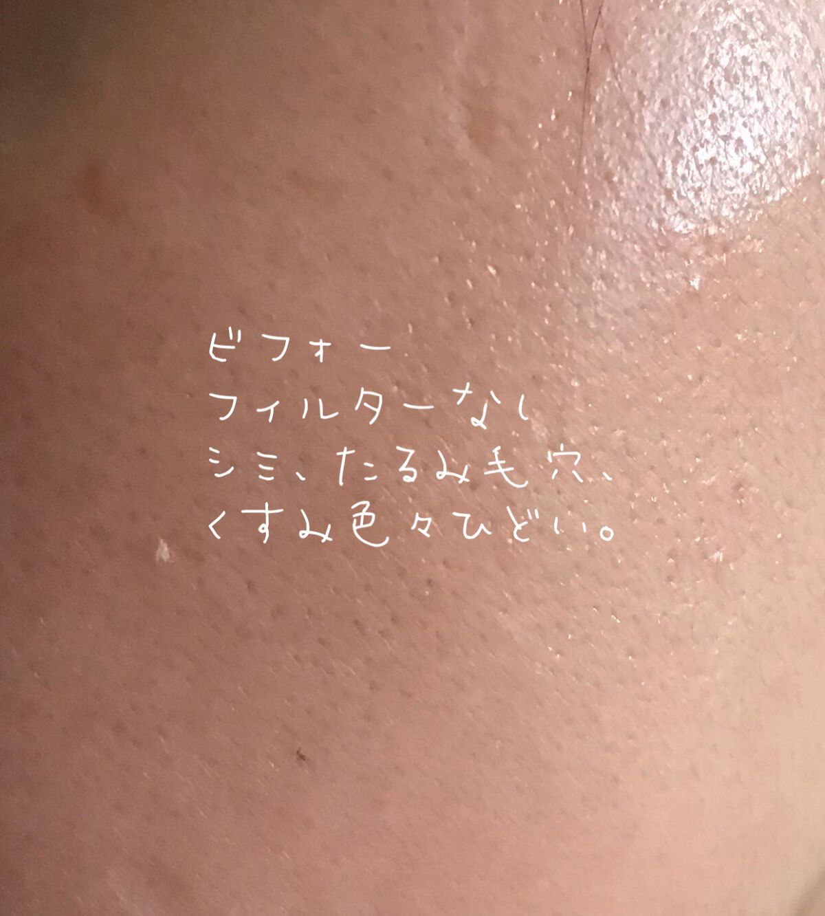 アルビオン シュクルホワイト パウダレスト/ALBION/プレストパウダーを使ったクチコミ（3枚目）