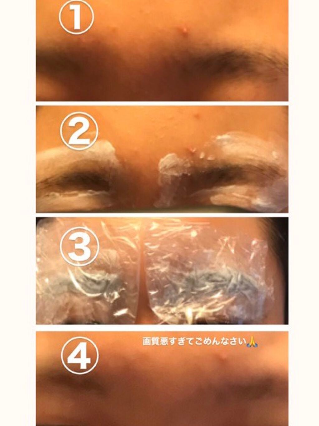 脱色クリーム 敏感肌用/エピラット/ムダ毛ケアを使ったクチコミ(3枚目)