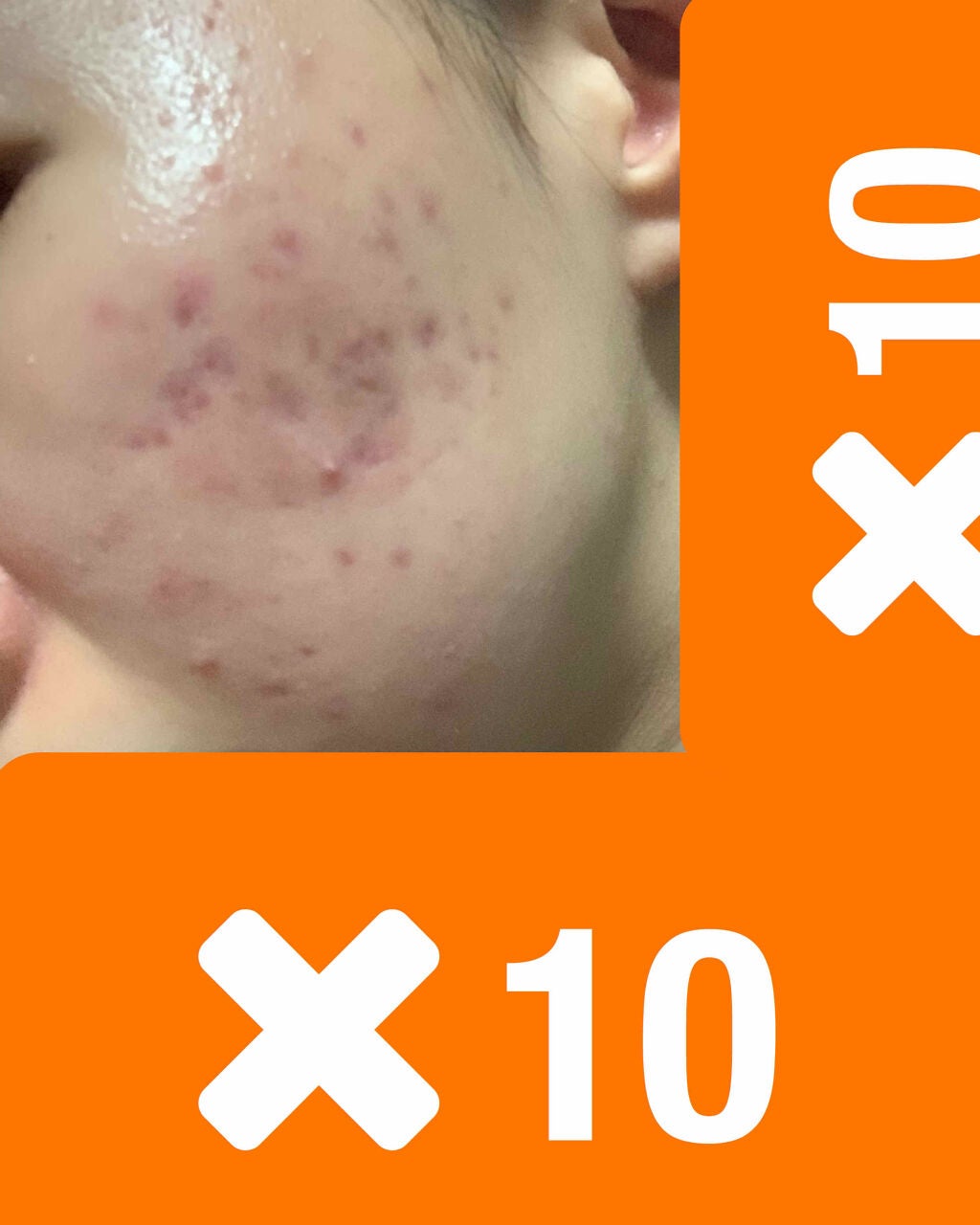 moo on LIPS 「〜助けてください〜久しぶりの顔写真、お目汚しお許しを😭全回投稿..」(2枚目)