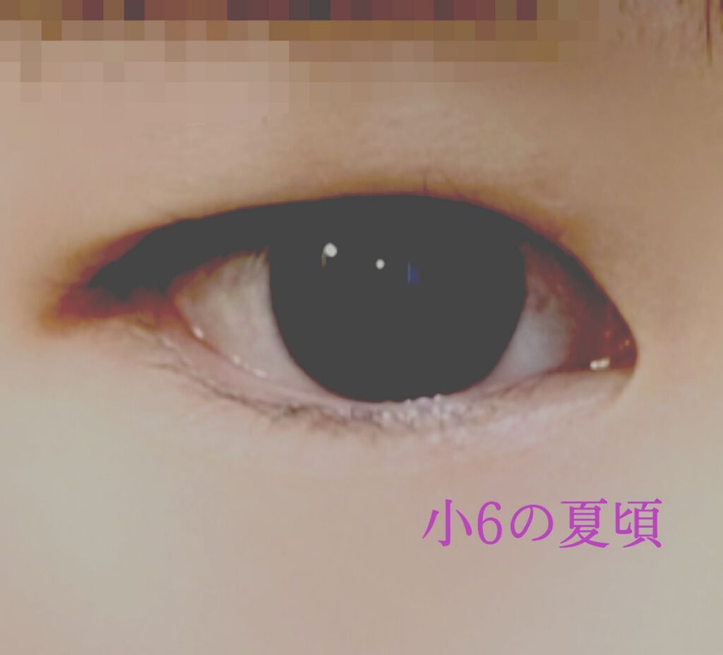 アイテープ 埋没式両面テープ/DAISO/二重まぶた用アイテムを使ったクチコミ（2枚目）